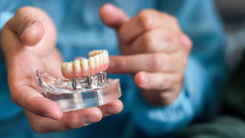 Facts About All-On-4 Dental Implants