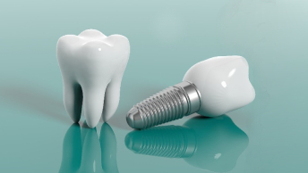 The Cost Of A Single Tooth & Full Mouth Implants